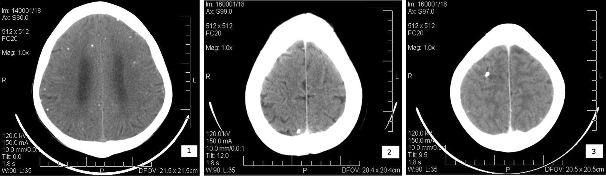 Fig. 1