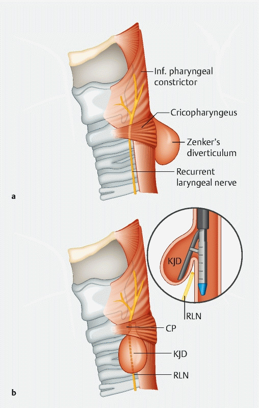 Fig. 1