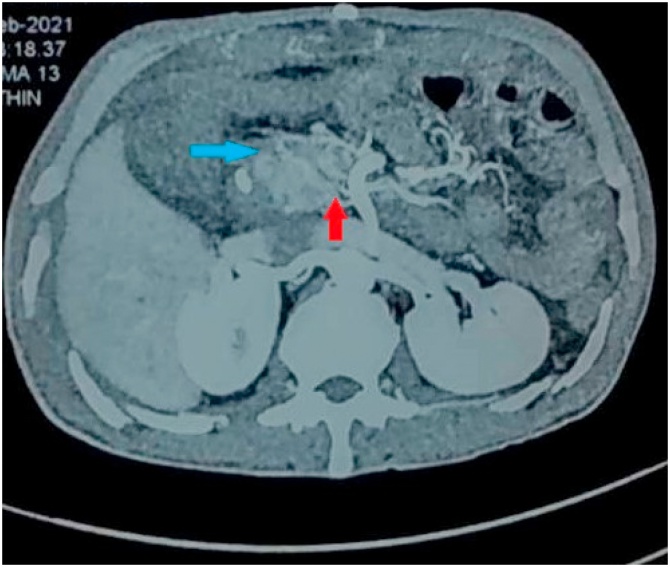 Fig. 2