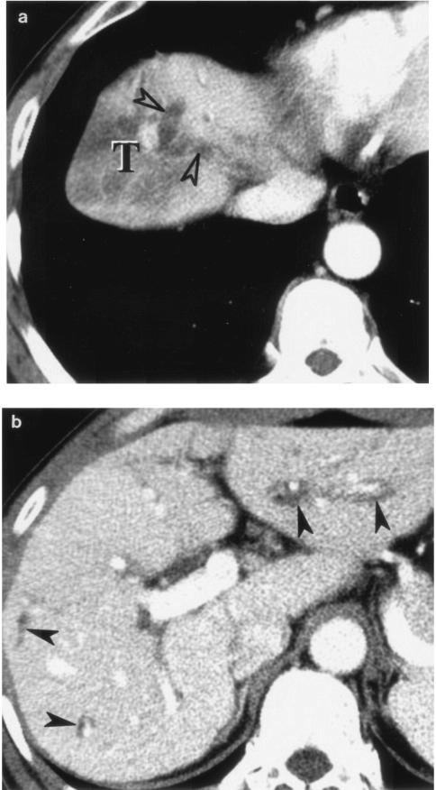 FIG. 8.