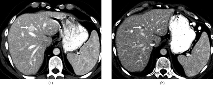 Figure 23