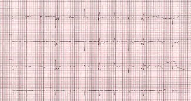 Figure 3