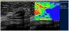 Figure 15