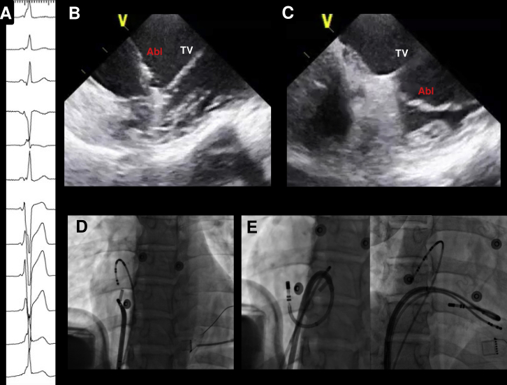 Supplemental Figure 3