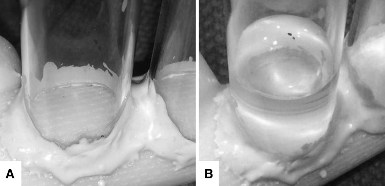 Fig. 2A–B