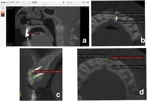 Fig. 4