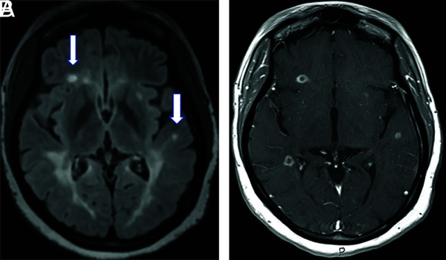 FIG 2.