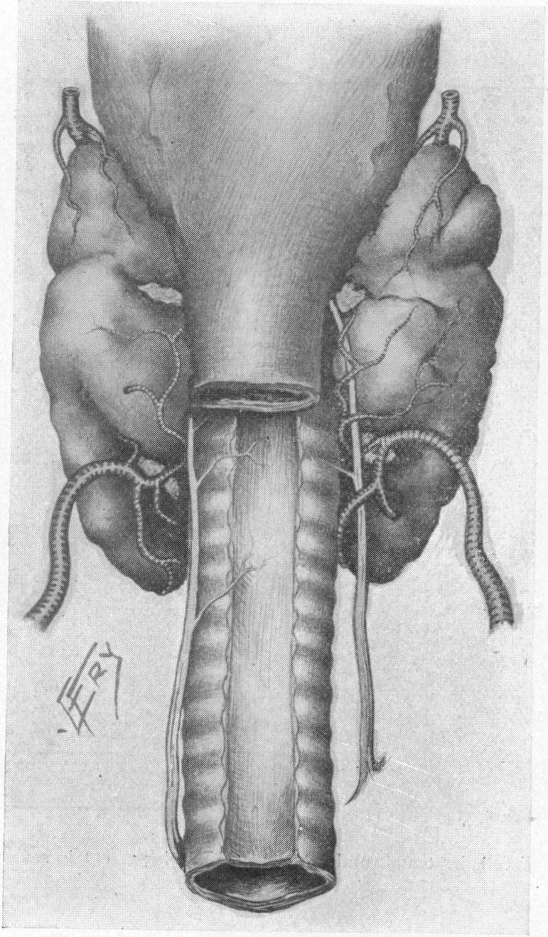 FIG. VI.