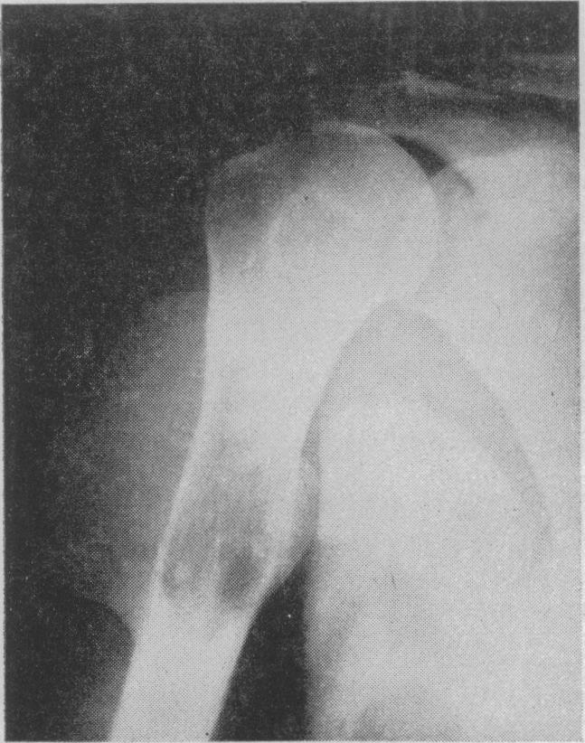 FIG. 8