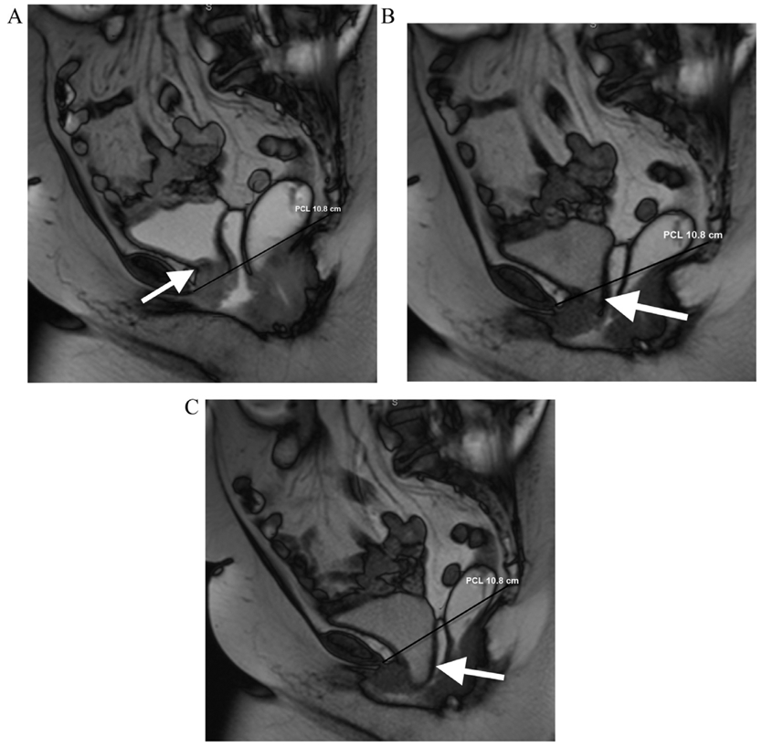 FIG 3.