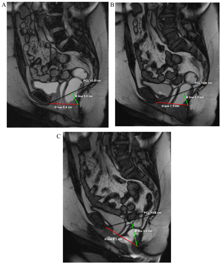 FIG 2.