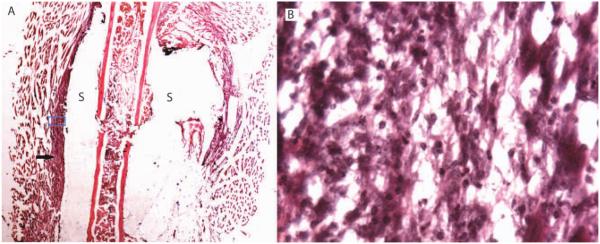 FIGURE 11