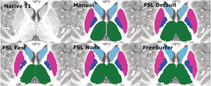 FIGURE 10