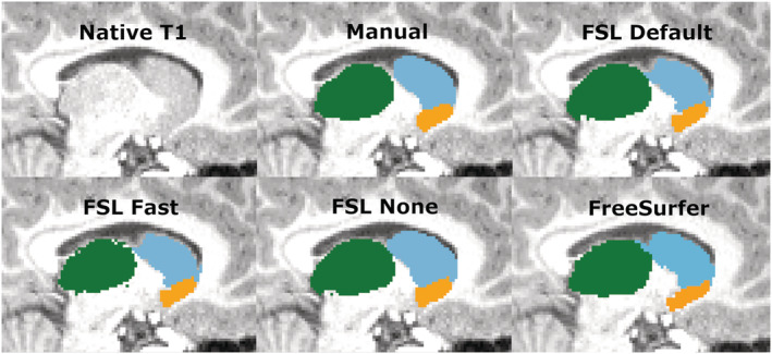 FIGURE 11