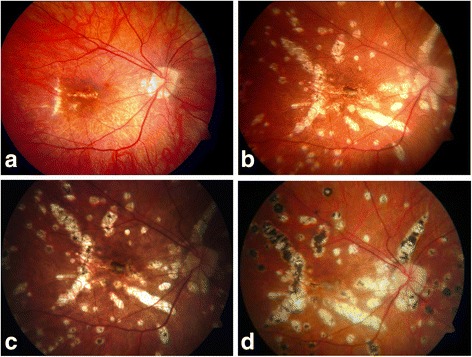 Fig. 1