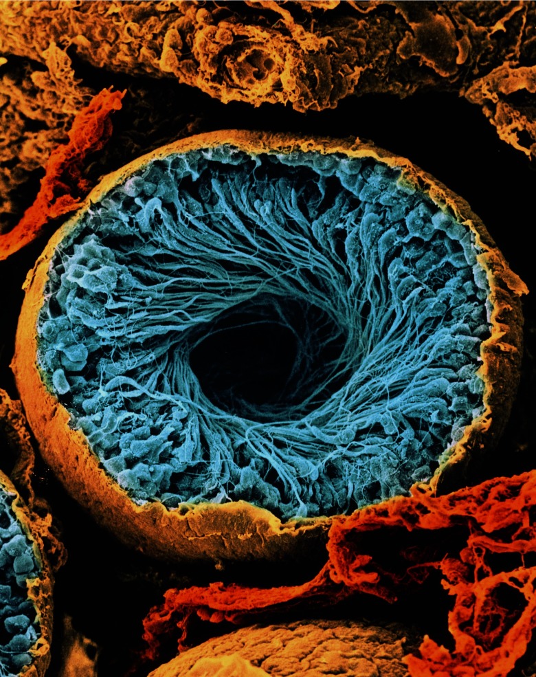 Scanning electron micrograph of a seminiferous tubule