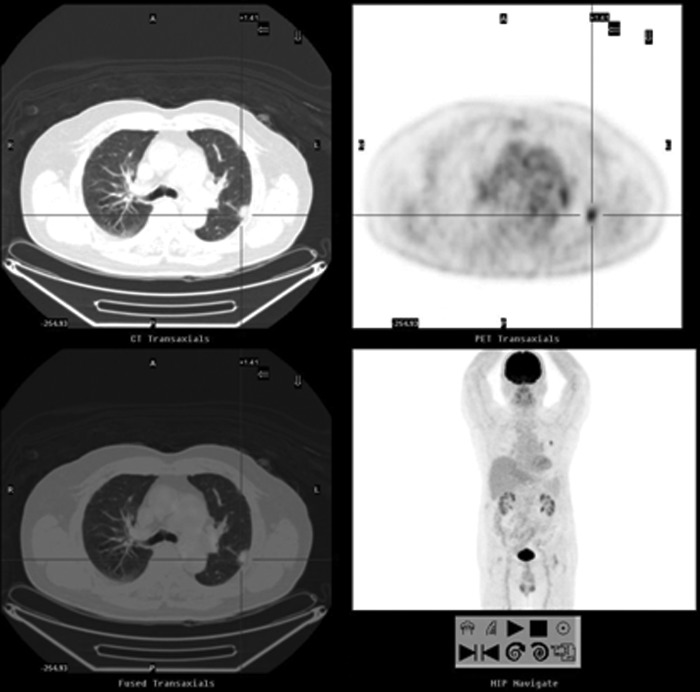 FIG. 3.