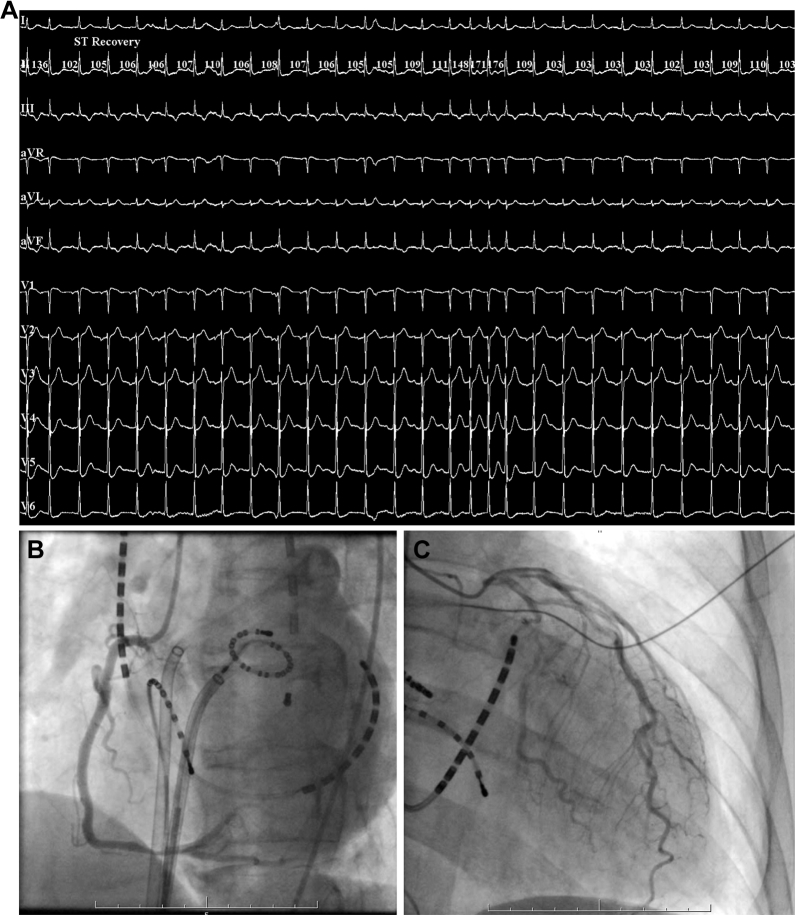 Figure 2