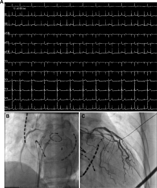 Figure 1