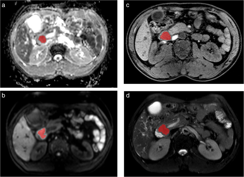 Fig. 2