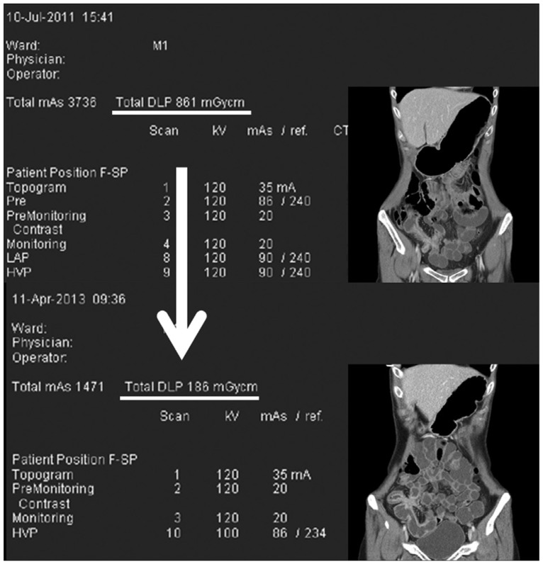 Fig. 13