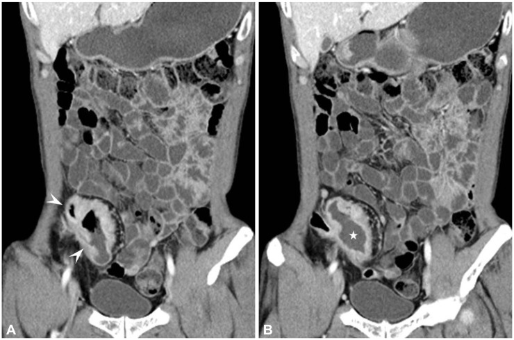 Fig. 11