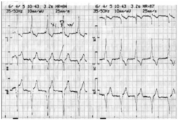 Figure 2: