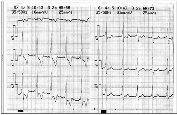 Figure 3: