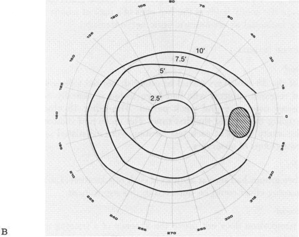 FIGURE 9 B