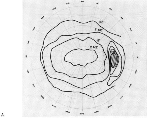 FIGURE 9 A