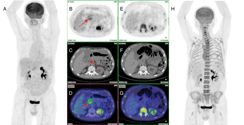 Fig. 4