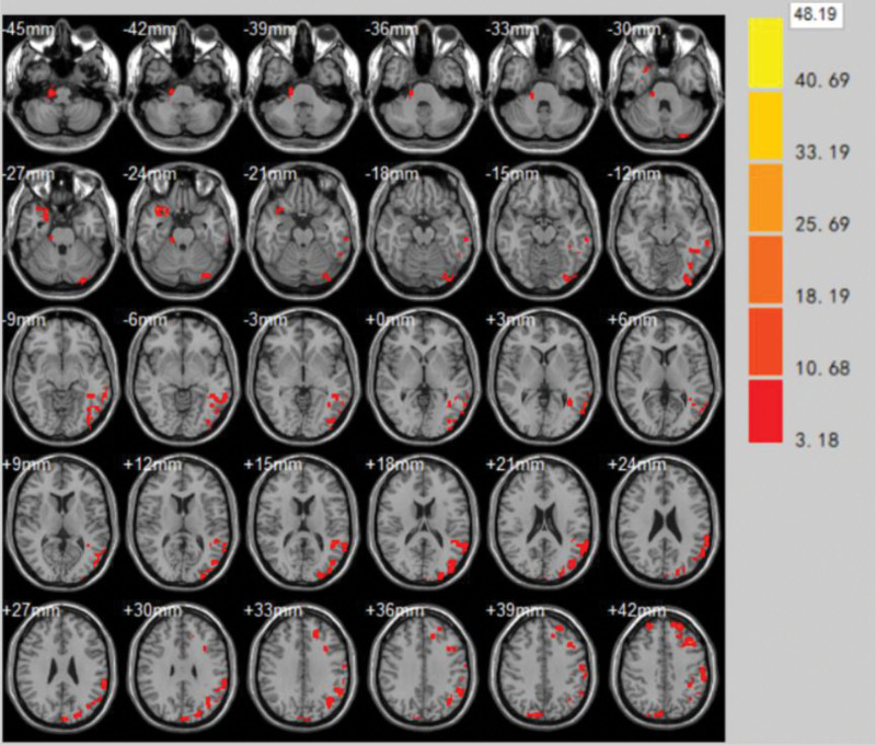 Figure 6.