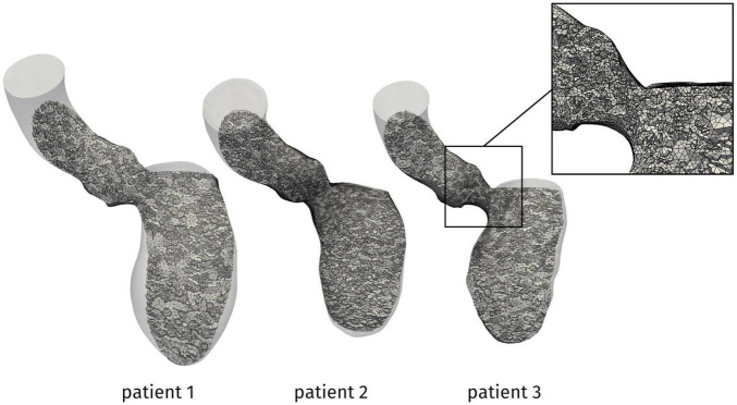 FIGURE 3