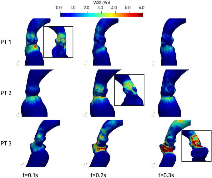 FIGURE 11