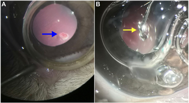 FIGURE 3