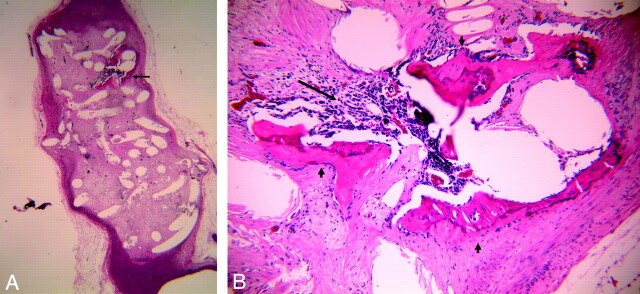 Fig 2.