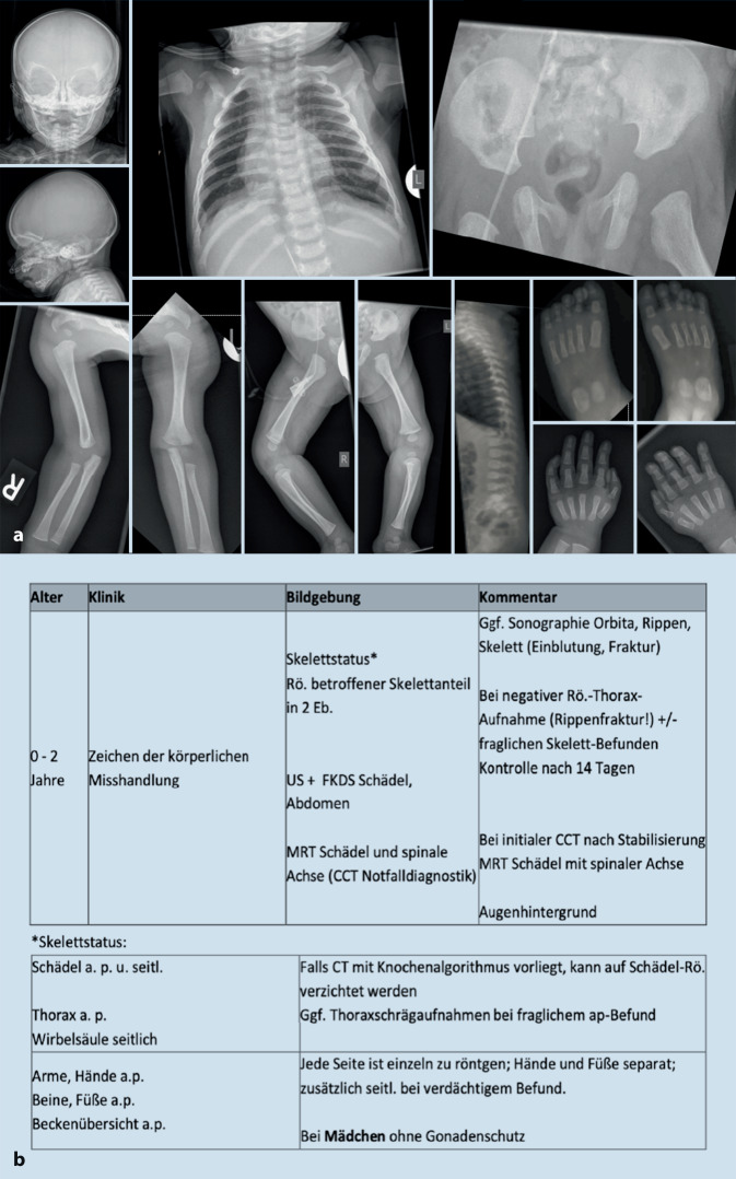graphic file with name 117_2021_872_Fig1_HTML.jpg