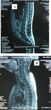 Figure 4 (A, B).