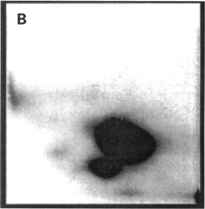 Figure 2. B