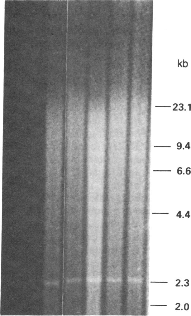 graphic file with name pnas00310-0207-a.jpg