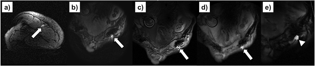 FIG. 10