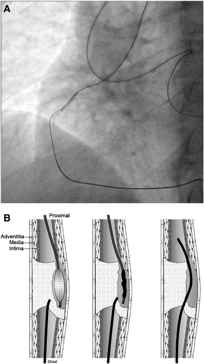 Fig. 10