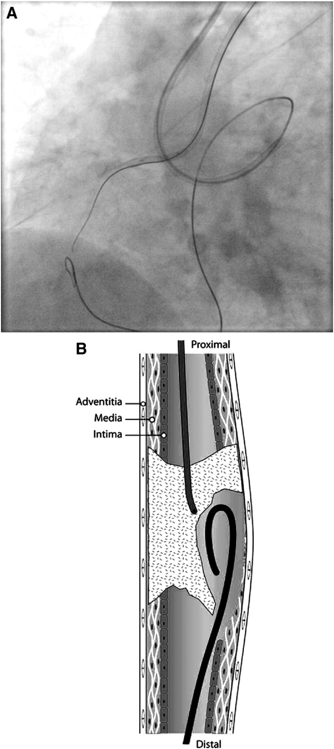 Fig. 14