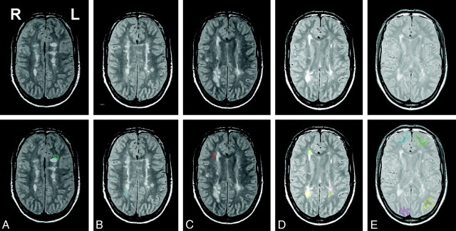 Fig 2.