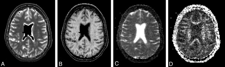 Fig 1.