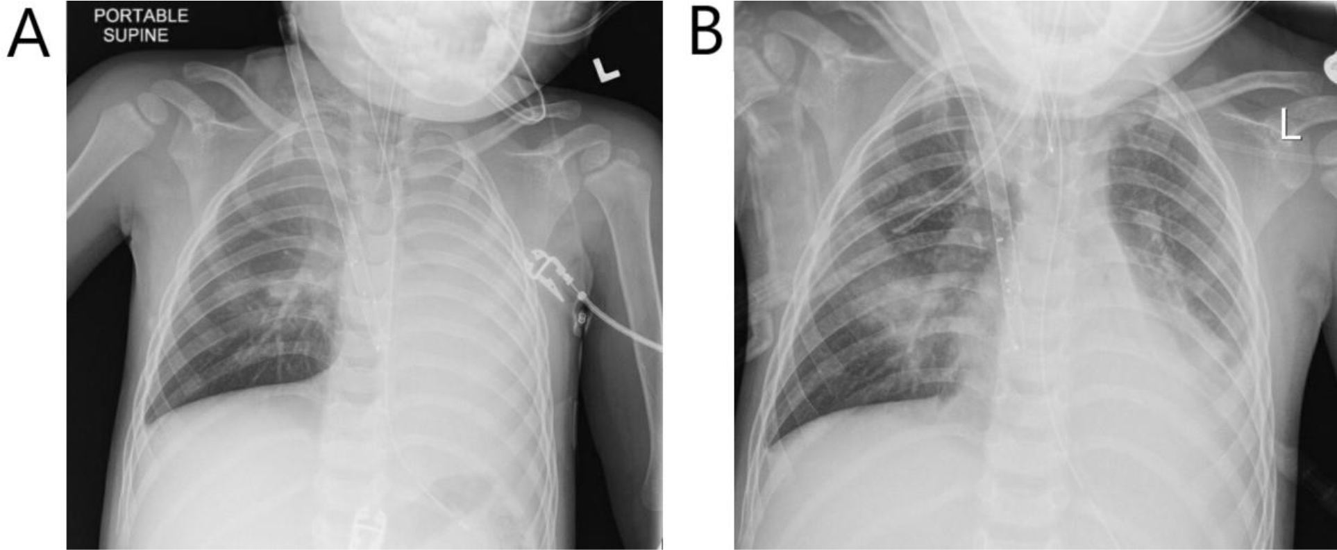 Figure 1A and 1B.