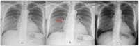 Fig 6