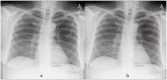 Fig 5