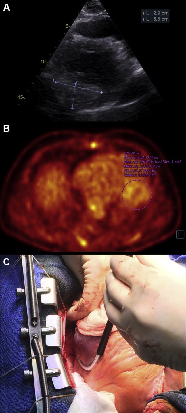 Figure 1