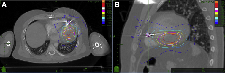 Figure 3